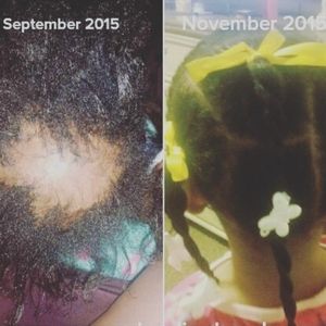 C4 Hair Growth and Moisturizing Cream